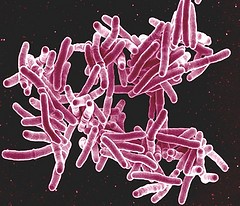 A microscopic image of tuberculosis