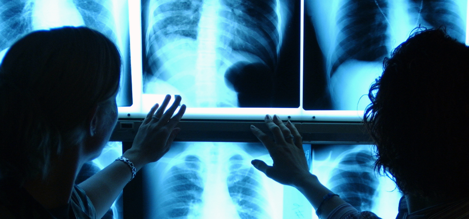 Two people looking at chest x-rays